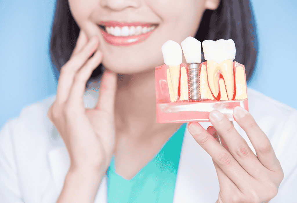 Dental Implants Northcote Northsore Auckland