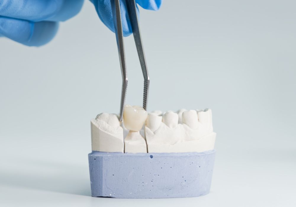 crowns and bridge dental treatments